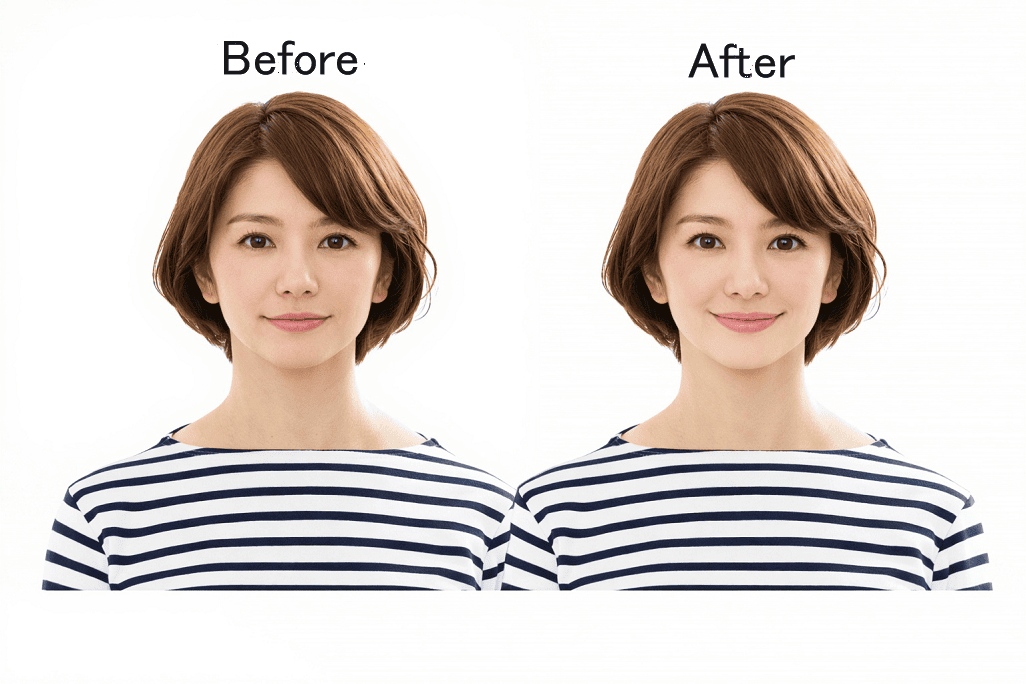 筋膜矯正before after・フェイスライン小顔効果（目黒 Blue Rose）