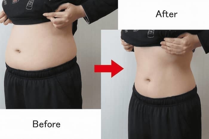 筋膜a矯正before after・ウエストサイズダウン・お腹周りのボディライン改善（目黒 Blue Rose）